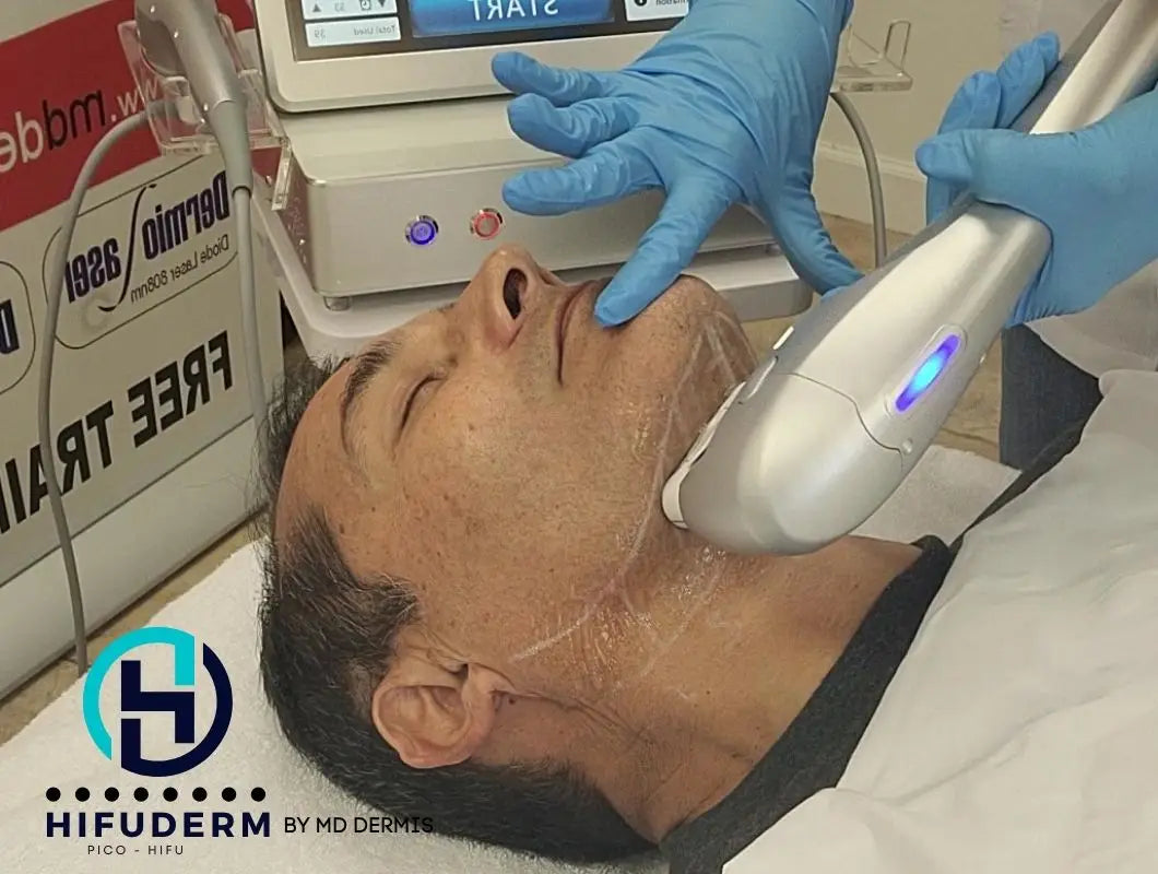 What is next after a Hifu - MIcrofocus Ultrasound (micro-hifu)?