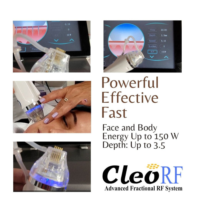 RF Microneedling,  radiofrequency microneedling machine,  Microneedling with RF, Cleo, Best  Radio Frequency microneedling machine, compare with Morpheus