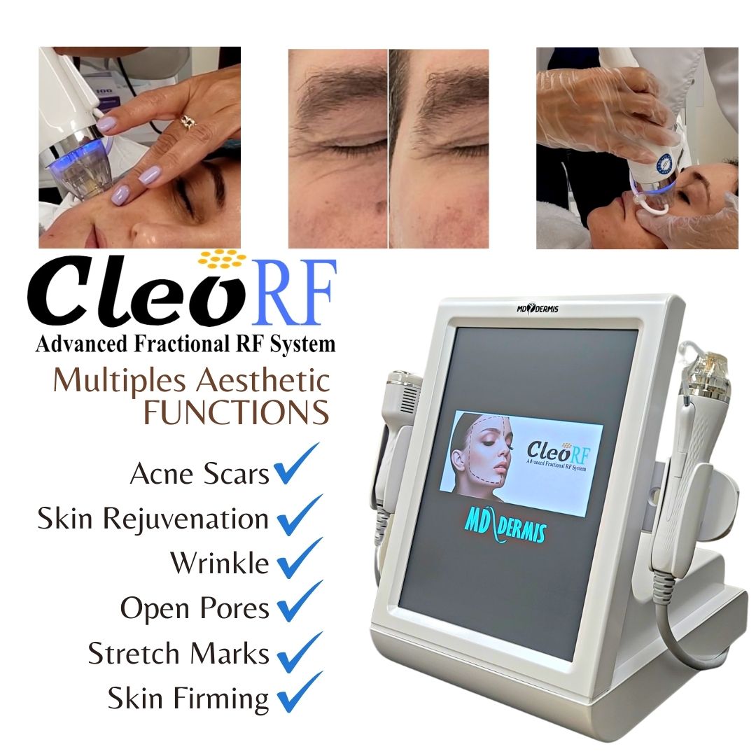 RF Microneedling,  radiofrequency microneedling machine,  Microneedling with RF, Cleo, best  Radio Frequency microneedling machine